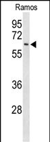 Rabbit Polyclonal Antibody to EIF2A