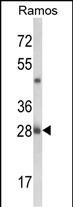 Rabbit Polyclonal Antibody to NUCKS1 (N-term)