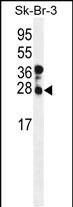 Rabbit Polyclonal Antibody to CHMP4B (N-term)