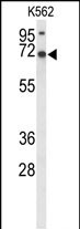 Rabbit Polyclonal Antibody to LRRC4