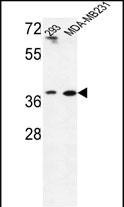 Rabbit Polyclonal Antibody to MAT2B (N-term)