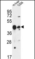Rabbit Polyclonal Antibody to PLA1A
