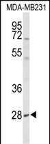 Rabbit Polyclonal Antibody to YIPF5 (N-term)