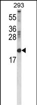 Rabbit Polyclonal Antibody to RBP2