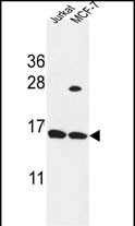 Rabbit Polyclonal Antibody to SPRR1A