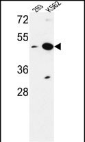 Rabbit Polyclonal Antibody to NUPL2 (N-term)