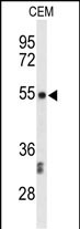 Rabbit Polyclonal Antibody to CENPI