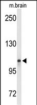 Rabbit Polyclonal Antibody to LONP2 (N-term)