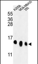 Rabbit Polyclonal Antibody to RPL36 (N-term)