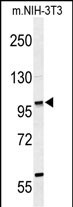 Rabbit Polyclonal Antibody to ZNF451 (N-term)
