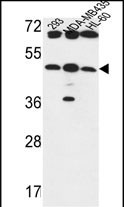 Rabbit Polyclonal Antibody to B3GNT5