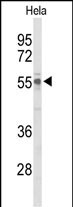 Rabbit Polyclonal Antibody to UPF3B