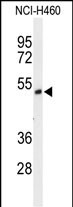 Rabbit Polyclonal Antibody to FXRD1