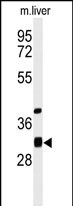 Rabbit Polyclonal Antibody to ECHDC1
