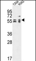 Rabbit Polyclonal Antibody to TBCE