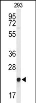 Rabbit Polyclonal Antibody to GGCT