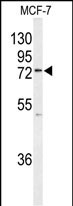 Rabbit Polyclonal Antibody to K0776