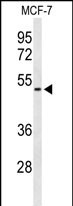 Rabbit Polyclonal Antibody to FLVC2