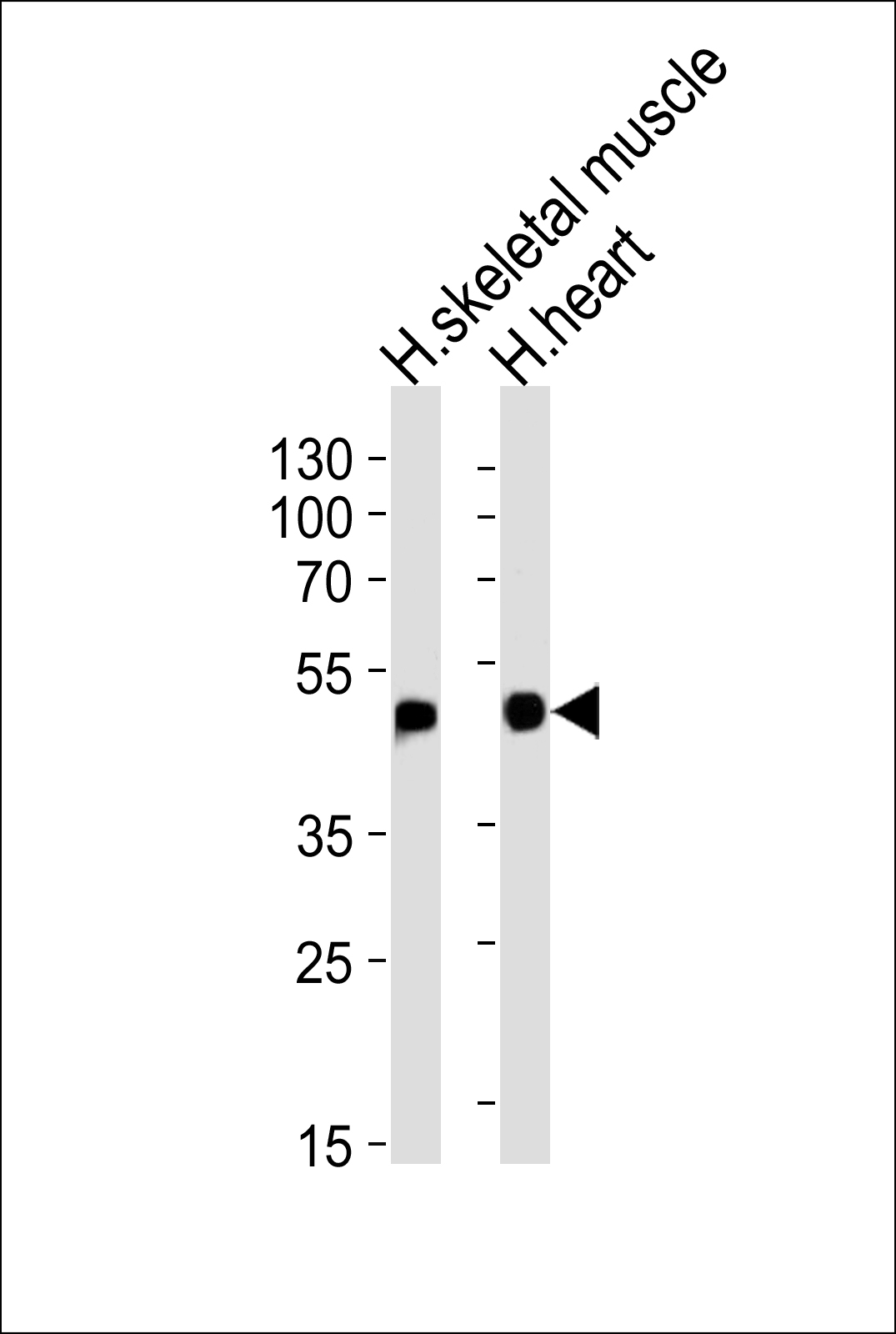 Rabbit Polyclonal Antibody to HFE2