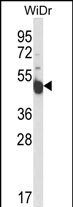 Rabbit Polyclonal Antibody to INSC