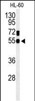 Rabbit Polyclonal Antibody to GDA (N-term)
