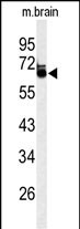 Rabbit Polyclonal Antibody to LRRTM1