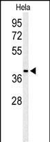 Rabbit Polyclonal Antibody to ADPRHL2 (N-term)