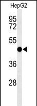 Rabbit Polyclonal Antibody to SGMS2