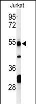 Rabbit Polyclonal Antibody to PRUNE