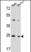 Rabbit Polyclonal Antibody to T4S4 (N-term)