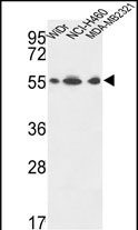 Rabbit Polyclonal Antibody to ATP5A1