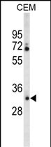 Rabbit Polyclonal Antibody to CA6