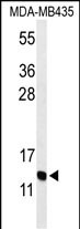 Rabbit Polyclonal Antibody to GNRH2