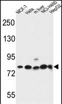Rabbit Polyclonal Antibody to GPHN