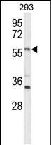 Rabbit Polyclonal Antibody to LMBR1L