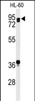Rabbit Polyclonal Antibody to PATL1