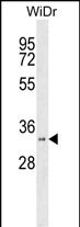 Rabbit Polyclonal Antibody to HSD17B11 (N-term)