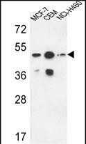 Rabbit Polyclonal Antibody to SGMS2