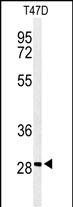 Rabbit Polyclonal Antibody to RHG19