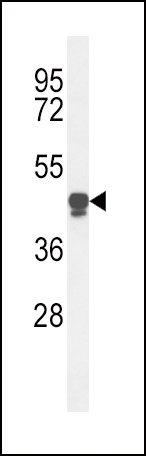Rabbit Polyclonal Antibody to PLA2G7
