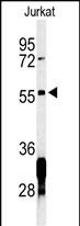 Rabbit Polyclonal Antibody to RNF8