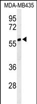 Rabbit Polyclonal Antibody to NARFL
