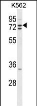 Rabbit Polyclonal Antibody to ZRANB1