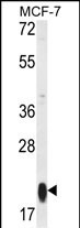 Rabbit Polyclonal Antibody to RT25