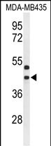 Rabbit Polyclonal Antibody to GPR17