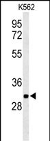 Rabbit Polyclonal Antibody to PGP (N-term)