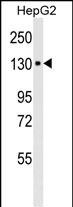 Mouse Monoclonal Antibody to ITA6
