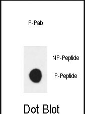 Rabbit Polyclonal Antibody to Phospho-ERBB3(Y1289)