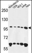 Rabbit Polyclonal Antibody to ANKFY1