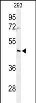 Rabbit Polyclonal Antibody to RRS1
